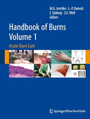 Bild des Verkufers fr Handbook of Burns Volume 1 : Acute burn care. zum Verkauf von CSG Onlinebuch GMBH