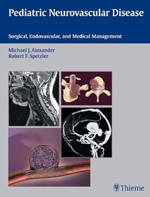 Imagen del vendedor de Pediatric neurovascular disease : surgical, endovascular, and medical management. a la venta por CSG Onlinebuch GMBH