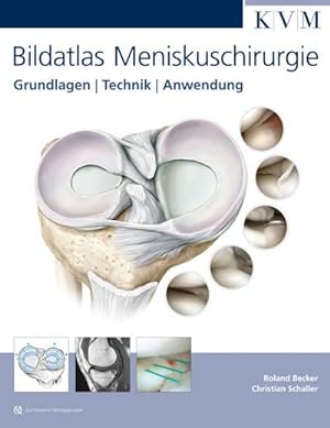 Seller image for Bildatlas Meniskuschirurgie : Grundlagen, Technik, Anwendung. for sale by CSG Onlinebuch GMBH
