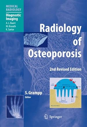 Bild des Verkufers fr Radiology of Osteoporosis, zum Verkauf von CSG Onlinebuch GMBH