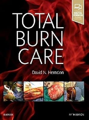 Seller image for Total Burn Care for sale by CSG Onlinebuch GMBH