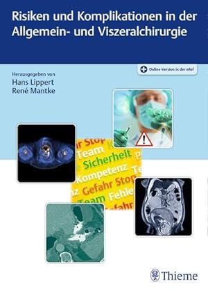 Immagine del venditore per Risiken und Komplikationen in der Allgemein- und Viszeralchirurgie venduto da CSG Onlinebuch GMBH