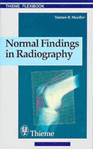 Seller image for Normal Findings in Radiography: . Zus.-Arb.: Torsten B. Mller Translated by Terry Telger 190 Illustrations (Thieme Flexibook) for sale by CSG Onlinebuch GMBH