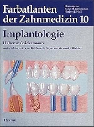 Seller image for Farbatlanten der Zahnmedizin, Bd.10, Implantologie for sale by CSG Onlinebuch GMBH