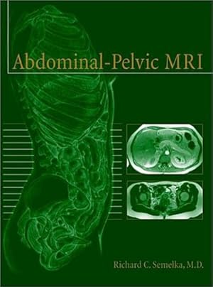 Seller image for Abdominal-Pelvic MRI for sale by CSG Onlinebuch GMBH