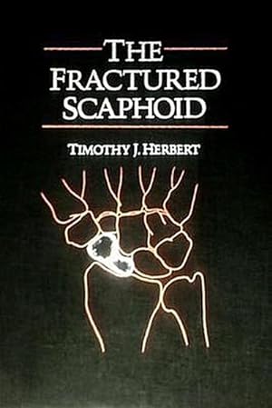 Bild des Verkufers fr The Fractured Scaphoid zum Verkauf von CSG Onlinebuch GMBH