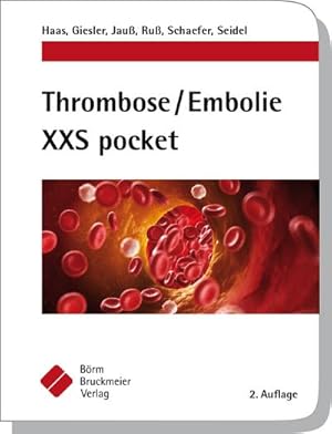 Bild des Verkufers fr Thrombose / Embolie XXS pocket (XXS pockets) zum Verkauf von CSG Onlinebuch GMBH