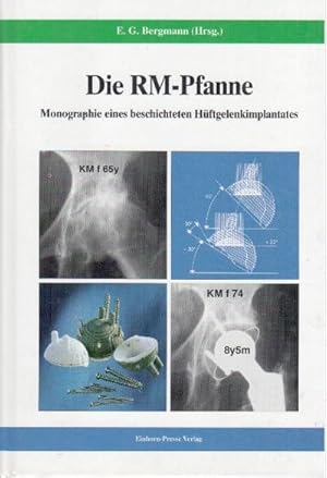 Bild des Verkufers fr Die RM-Pfanne: Monographie eines beschichteten Hftgelenkimplantates zum Verkauf von CSG Onlinebuch GMBH