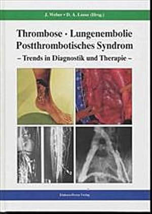 Seller image for Thrombose - Lungenembolie - Postthrombotisches Syndrom: Trends in Diagnostik und Therapie for sale by CSG Onlinebuch GMBH