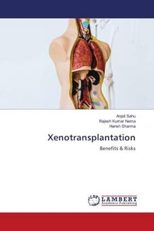 Seller image for Xenotransplantation : Benefits & Risks for sale by AHA-BUCH GmbH