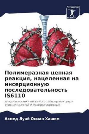 Immagine del venditore per Polimeraznaq cepnaq reakciq, nacelennaq na insercionnu posledowatel'nost' IS6110 : dlq diagnostiki legochnogo tuberkuleza sredi sudanskih detej i molodyh wzroslyh venduto da AHA-BUCH GmbH