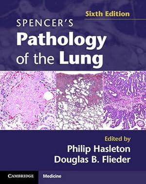 Image du vendeur pour Spencer's Pathology of the Lung 2 Part Set with DVDs (Book & Merchandise) mis en vente par CitiRetail