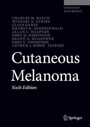 Bild des Verkufers fr Cutaneous Melanoma (Hardcover) zum Verkauf von CitiRetail
