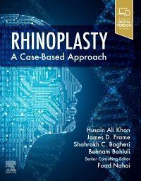 Bild des Verkufers fr Rhinoplasty: A Case-Based Approach zum Verkauf von moluna