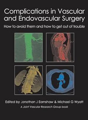 Immagine del venditore per Complications in Vascular & Endovascular Surgery (Hardcover) venduto da CitiRetail