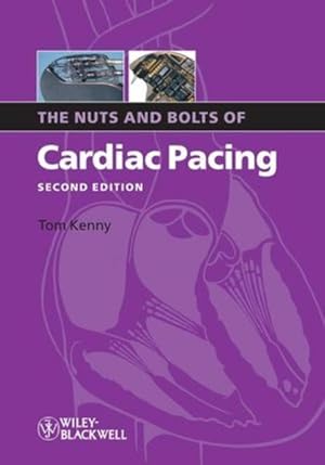 The Nuts and Bolts of Cardiac Pacing (Nuts and Bolts Series (Replaced by 5113))