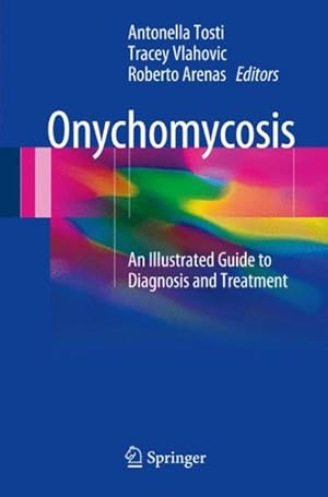 Imagen del vendedor de Onychomycosis : An Illustrated Guide to Diagnosis and Treatment a la venta por GreatBookPrices