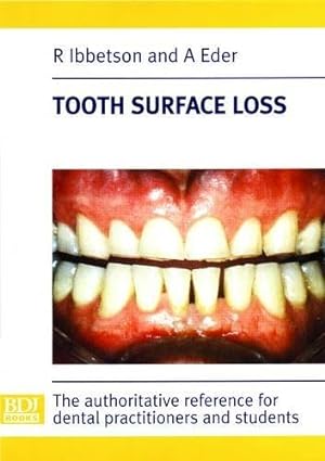 Image du vendeur pour Tooth Surface Loss mis en vente par WeBuyBooks