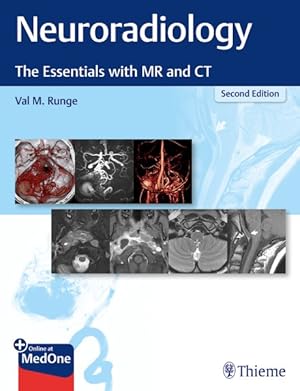 Seller image for Neuroradiology : The Essentials With Mr and Ct for sale by GreatBookPrices