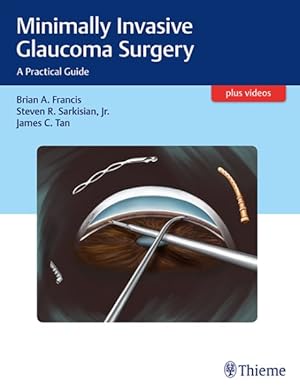 Seller image for Minimally Invasive Glaucoma Surgery : A Practical Guide for sale by GreatBookPrices