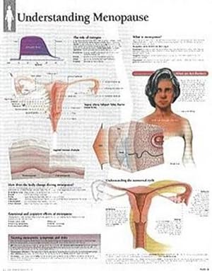 Seller image for Understanding Menopause Laminated Poster (Paperback) for sale by Grand Eagle Retail