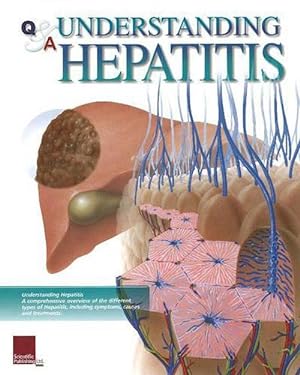 Seller image for Q&A Understanding Hepatitis (Spiral) for sale by Grand Eagle Retail