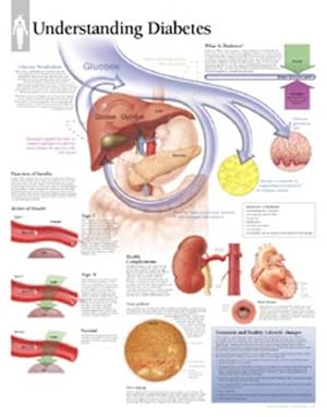 Seller image for Understanding Diabetes Paper Poster (Paperback) for sale by Grand Eagle Retail