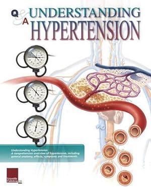 Seller image for Understanding Hypertension Flip Chart (Spiral) for sale by Grand Eagle Retail