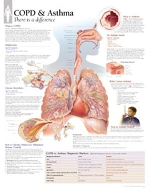 Image du vendeur pour COPD & Asthma Paper Poster (Paperback) mis en vente par Grand Eagle Retail