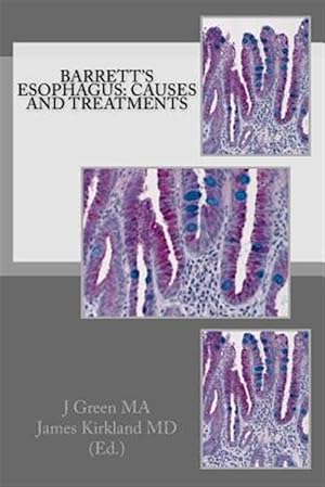 Imagen del vendedor de Barrett's Esophagus : Causes and Treatments a la venta por GreatBookPrices