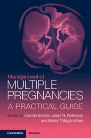 Bild des Verkufers fr Management of Multiple Pregnancies : A Practical Guide zum Verkauf von AHA-BUCH GmbH