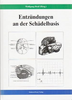 Seller image for Entzndungen an der Schdelbasis for sale by Buchhandlung Loken-Books