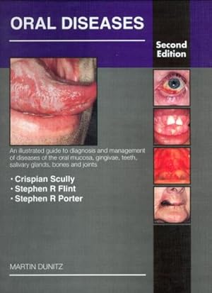Seller image for Oral Diseases: An Illustrated Guide to Diagnosis and Management of Diseases of the Oral Mucosa, Gingivae, Teeth, Salivary Glands, Bones and Joints for sale by WeBuyBooks
