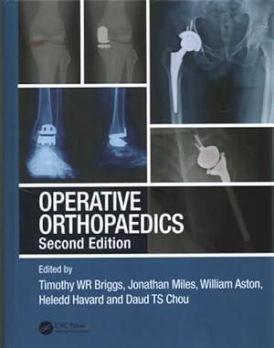 Bild des Verkufers fr Operative Orthopaedics : The Stanmore Guide zum Verkauf von GreatBookPrices