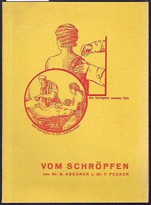 Vom Schröpfen