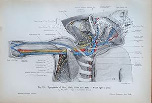 PAEDIATRIC LYMPHATIC SYSTEM Original Antique Anatomy Lithographed Print 1906