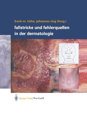Bild des Verkufers fr Fallstricke und Fehlerquellen in der Dermatologie zum Verkauf von AHA-BUCH GmbH