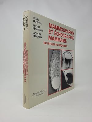 Mammographie et ÃÂchographie Mammaire de l'Image au Diagnostic