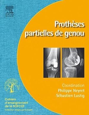 prothèses partielles du genou