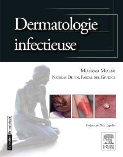 dermatologie infectieuse