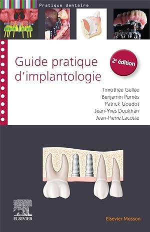 guide pratique d'implantologie (2e édition)