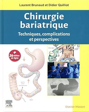 chirurgie bariatrique ; techniques, complications et perspectives