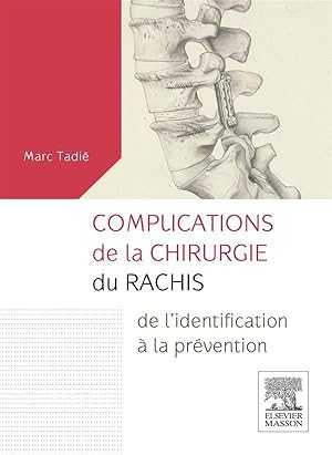 complications de la chirurgie du rachis ; de l'identification à la prévention