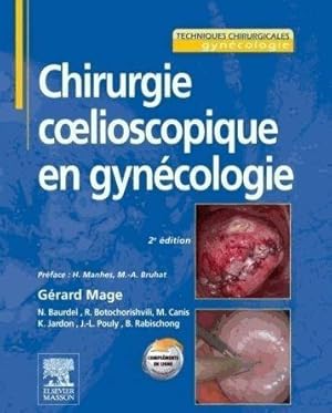 chirurgie coelioscopique en gynécologie (2e édition)
