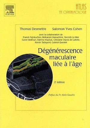 Dégénérescence maculaire liée à l'âge