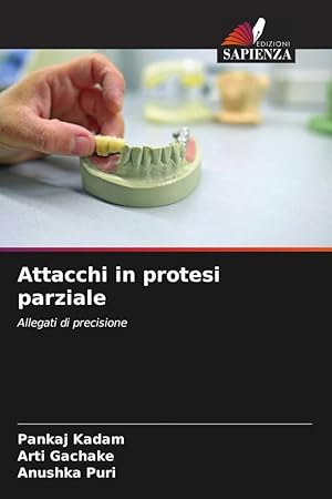 Bild des Verkufers fr Attacchi in protesi parziale zum Verkauf von moluna