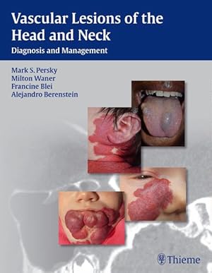 Image du vendeur pour Vascular Lesions of the Head and Neck: Diagnosis and Management mis en vente par Studibuch