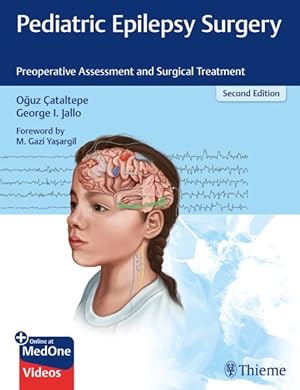 Seller image for Pediatric Epilepsy Surgery : Preoperative Assessment and Surgical Treatment for sale by GreatBookPrices