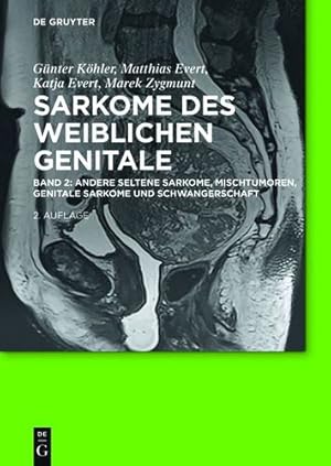 Immagine del venditore per Andere Seltene Sarkome, Mischtumoren, Genitale Sarkome Und Schwangerschaft: Andere Seltene Sarkome, Mischtumoren, Genitale Sarkome Und Schwangerschaft (German Edition) [Hardcover ] venduto da booksXpress