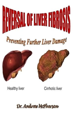 Immagine del venditore per Reversal of Liver Fibrosis: Preventing Further Liver Damage venduto da GreatBookPrices